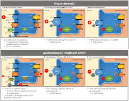 Image result for Hypochloremia