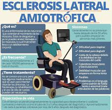 Francisco javier rodríguez de rivera garrido. Que Es La Esclerosis Lateral Amiotrofica Ela Parapupas