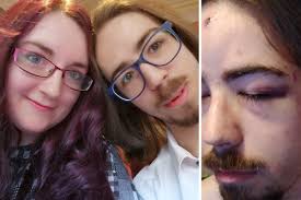 Student knocked unconscious in unprovoked attack by teenager in Port Seton 