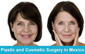 Plastic and Cosmetic Surgery in Mexico