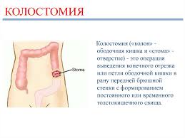 Maybe you would like to learn more about one of these? Vidy Kolostom Prezentaciya Onlajn