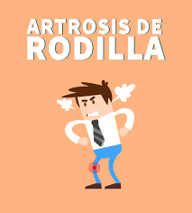 Learn vocabulary, terms and more with flashcards, games and other study tools. Artrosis De Rodilla Fisiosite Blogfisiosite Blog