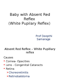 Image result for Red Reflex