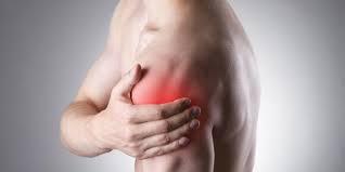 Impingement Syndrom