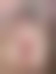 グロ注意】うそ？私のおまんこ吸いついちゃって離れない！って感じのエロ画像【子宮脱】 - エロ２次画像