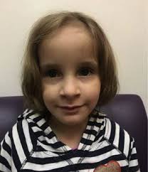 De Novo Variants in the ATPase Module of MORC2 Cause a Neurodevelopmental  Disorder with Growth Retardation and Variable Craniofa