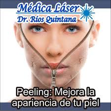 Bioplastia de Nariz $15mil