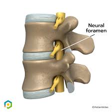 Image result for Lumbar vertebrae