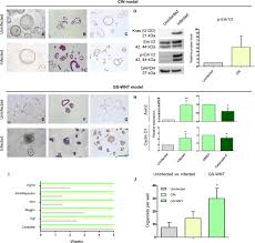 Stomach cancer is specified by the growth of cancerous cells within the lining of the stomach. Human Gastric Cancer Modelling Using Organoids Gut
