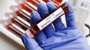 This means that load shedding starts with the current load shedding groups are not fixed and merely indicate the areas. Stanger Hospital Closes After 16 People Including Four Doctors Test Positive For Covid 19