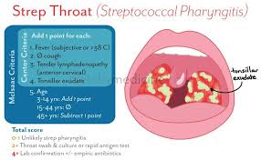Sketchy Medicine Streptococcal Pharyngitis Pharyngitis Pediatric Nurse Practitioner