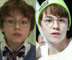 Wattpad Random Puberty Isn T The Only Way To Glow Up Inspired By Kpopsurgery Com Read Disclaimer Feel Free To Di Vernon Seventeen Kpop Vernon Seventeen