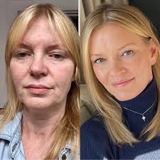 🤯Tina just got featured in @people!!! Senior Style News Editor Hedy  Phillips messaged me a few weeks ago when Tina's deep plane facelift and  deep necklift transformation went viral. She (@justhedyj) then