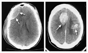 How much does a ct scanner cost? Ct Scan Ct Scan India India Computed Tomography Scan Ct Scan Cost