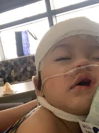 COVID and children: Doctors worry about disparities in kids of color