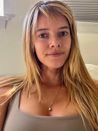 no make up and lips are so chapped after the dentist today but it's all  fine. I'm just so happy I'm finally done with my Invisalign! 🦷