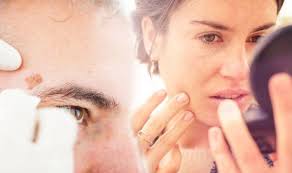 There are several ways to get rid of. Skin Cancer The Checklist To Know If Your Mole Or Freckle May Be Cancerous Daily Star Post