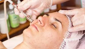 Check spelling or type a new query. Ice Pick Scars Treatment Options Causes And Prevention