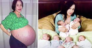Tsotetsi said doctors had initially believed sithole was pregnant with sextuplets, but they later discovered their scans had missed two. Octomom S Octuplets Are All Grown Up This Is The Children Now Age 11