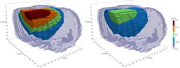 More than 150 different brain tumors have been documented, but the two main groups of brain tumors are termed primary and metastatic. Tailoring Cancer Treatments To Individual Patients Latest News Texas Advanced Computing Center