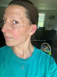 Birth tissue donations: Tennessee doctors help pioneer research