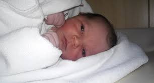 Image result for Allergic Colitis of Infancy