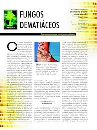 Santa catarina investigam casos prováveis de mucormicose, infecção causada por um fungo conhecido como. Pdf Fungos Negros Que Afetam Animais Plantas E O Homem
