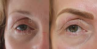 retinol to fade permanent makeup