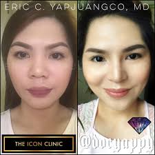 The ICON Clinic