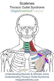 Trigger Points Stiff Swollen Hands In The Morning Trigger Points Swollen Hands Massage Therapy