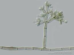Fonsecaea is a genus of fungi in the family herpotrichiellaceae. Fonsecaea Coat Rack Fungos Aulas