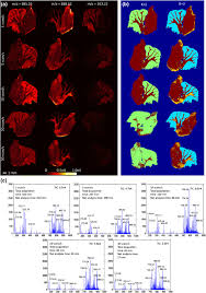 Faster More Reproducible Desi Ms For Biological Tissue Imaging Springerlink