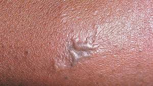 24/7 phone support · up 50% off on lab tests · chat with us now Do You Have An Std You Re Not The Only One Everyday Health