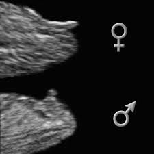 Healthcare providers can do this test toward the end of the first trimester, usually at about 10. And That Makes Five Baby Ultrasound Girl Ultrasound Pictures Ultrasound Gender