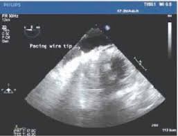 Case Report Archives