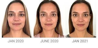 Danielle collins, tv's face yoga expert, believes we should all have the opportunity to look and feel the very best we can for our age and to care for our face, body and mind using natural and holistic techniques. About Danielle Collins The Face Yoga Expert