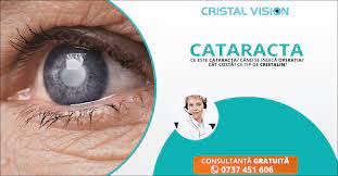 Care sunt riscurile chirurgiei cataractei? Ce Este Cataracta Cand Se Indica Operatia Cat Costa Si Cum Alegem Cristalinul Potrivit