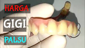 Bersihkan mulut anda setelah mengeluarkan gigi palsu anda. Berapa Harga Gigi Palsu Inilah Jawabannya Youtube