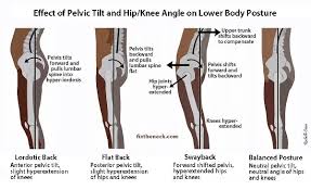 You may have difficulty doing everyday tasks like walking or standing up. A Locked Knee Is Not Secure Embody Movement Pilates Studio