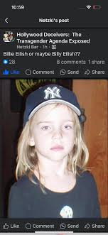 Adam's apple is more prominent in ....... A. Female Child B. Male Child C.  Adult female D. Adult male