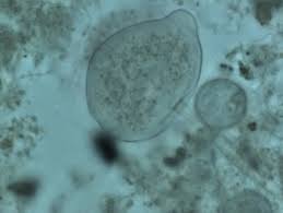 Examples of microscopic photographs of microorganisms | Download Scientific  Diagram