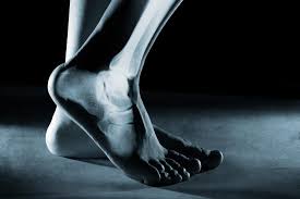 Stress fractures are also common in the calcaneus (heel). Hairline Fracture Symptoms Treatment And Causes