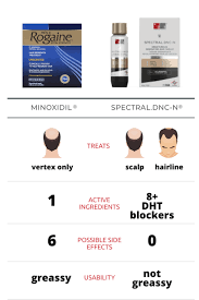 New hairs grew all over my scalp. Does Minoxidil Rogaine Work For Frontal Baldness Ds Healthcare Group