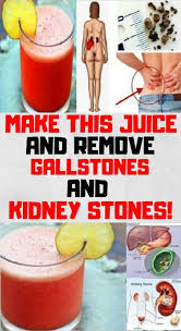 How To Make The Most Powerful Juice That Naturally Removes Kidney Stones And Gallstones Gallstones Kidney Stones Kidney Stones Remedy