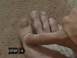 How To Know If Your Toe Is Broken Youtube