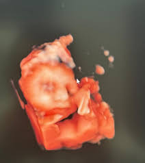 Dr. Carlos Ulises Romero Zarate Radiólogo, Huehuetoca