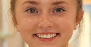 Berry spikers bounce Oilers