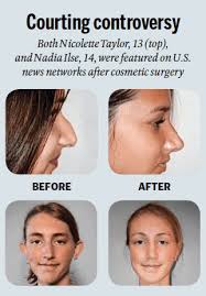 Plastic surgery: Where do parents draw the line?