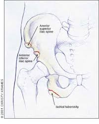 Image result for Groin Disruption