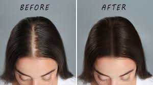Coconut oil for hair growth: Explained: What is the correct way of  massaging Coconut Oil to regrow hair in bald patches? | - The Times of India